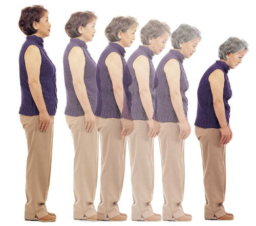 Can Scoliosis Get Worse as You Age | Scolination