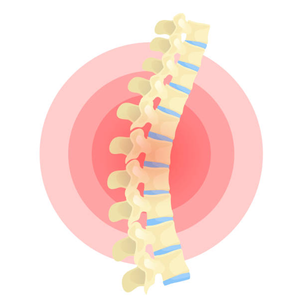 Understanding Scoliosis and Lordosis Link